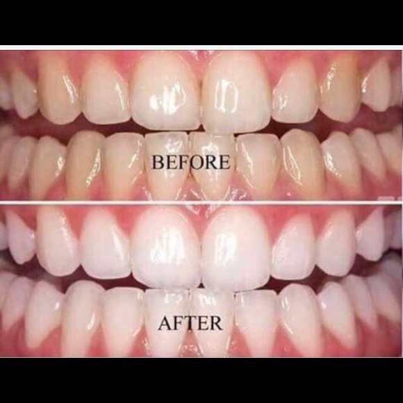 Whitening toothpaste - Picture 6 of 8